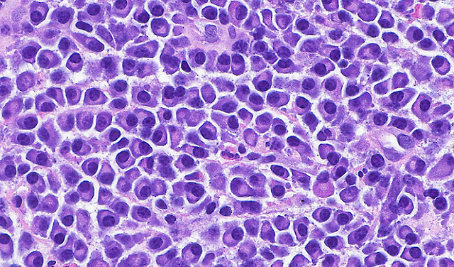 بحث علمي يقود لاكتشاف مهم في أبحاث الشيخوخة